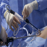 General laparoscopic clinic in Solapur | General laparoscopic surgery in Solapur